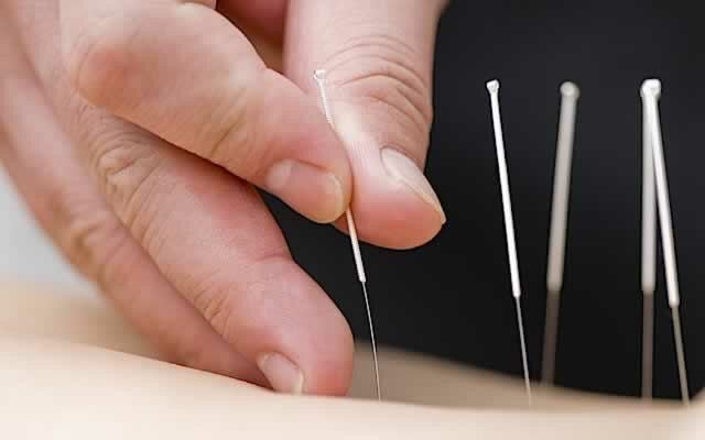 1_a-guide-to-acupuncture