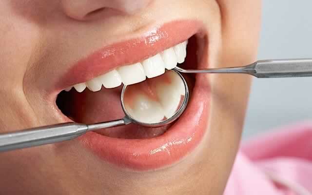 1_how-to-prevent-tooth-decay