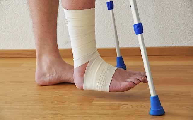 1_how-to-treat-an-ankle-fracture
