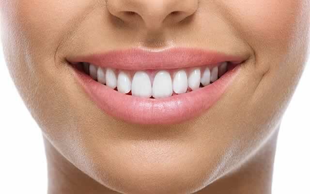 1_how-to-whiten-teeth