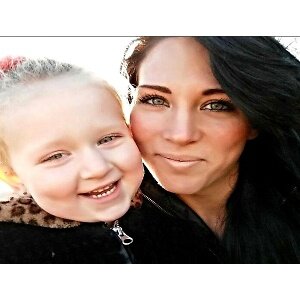 Woman lost part of her face to a misdiagnosis of hay fever