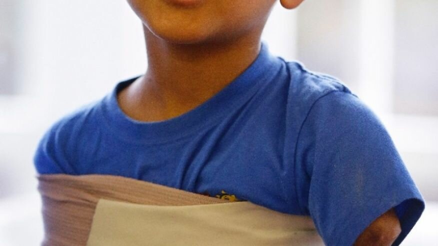 Refugee mental health needs could overwhelm, experts fear