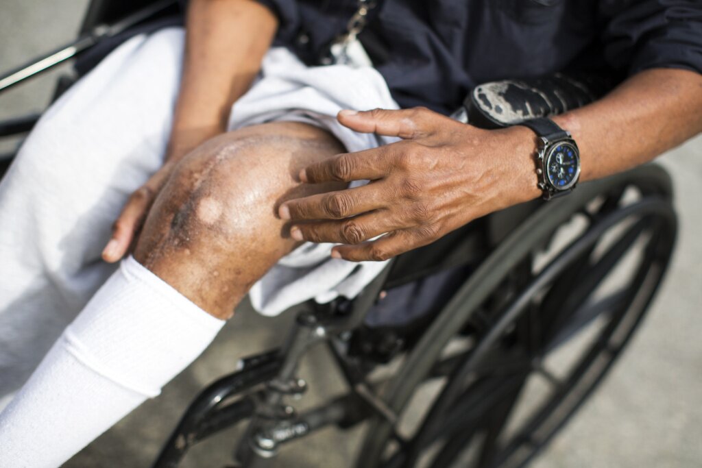 Recuperative caring offers a safe, purify place to redeem for ill homeless